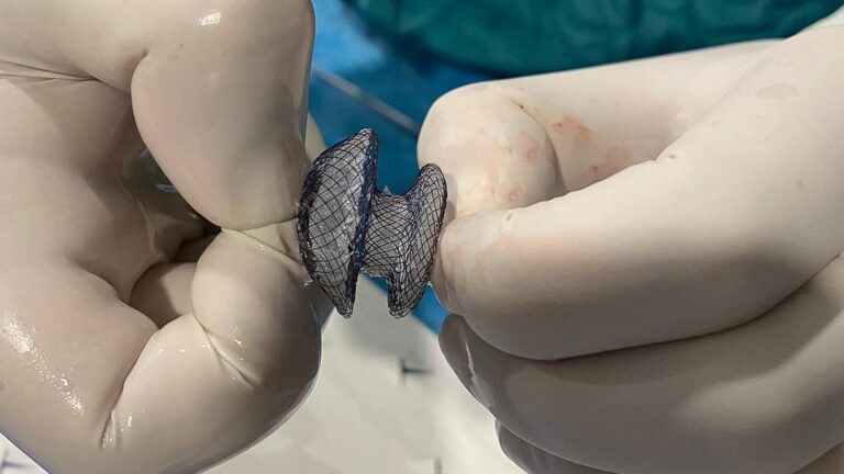 Çarpıntı, nefes darlığı ve yorgunluk şikayetiniz varsa dikkatli olun! Kalp deliği artık kapalı yöntemle tedavi edilebilecek